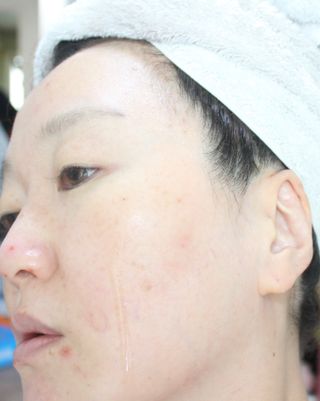 [스킨1004] 마다가스카르 센텔라 앰플 100ml — 5점을 준 리뷰어가 2024년 5월 올린 사용 사진