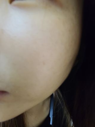 랑팡 EGF+FGF 10ppm 리포좀 앰플 원액 10ml — 5점을 준 리뷰어가 2021년 11월 올린 사용 사진