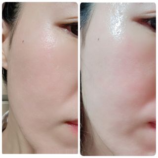 지슬리 GSLEY 지슬리 버블폭탄팩 — 4점을 준 리뷰어가 2021년 3월 올린 사용 사진