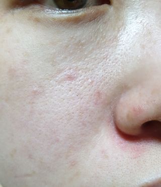 체르엠  프루브 콜라겐 앰플세럼 60ml 1병 — 5점을 준 리뷰어가 2021년 10월 올린 사용 사진