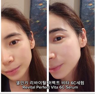 ★셀인키 8종 홈케어라인★  [신부관리템]부산해운대,강남,제주도 등 전국 병원,피부샵 입점중 — 5점을 준 리뷰어가 2024년 3월 올린 사용 사진