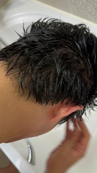 닥터시드 티트리 앤 라임 비건 지성케어 쿨 탈모 캡슐 트리트먼트 두피 팩 — 5점을 준 리뷰어가 2024년 7월 올린 사용 사진