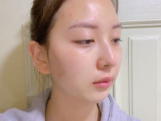 마이디플러스 아토비옴 4종 기프트 패키지 — 5점을 준 리뷰어가 2021년 11월 올린 사용 사진