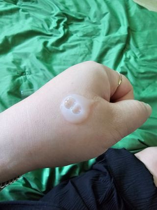 나우 [리브엠] 123억개 엑소좀으로 채운 눈부신 광채, 엑소코어 화이트닝 텐션 앰플 — 5점을 준 리뷰어가 2023년 8월 올린 사용 사진