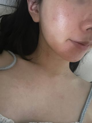 [스킨1004] 마다가스카르 센텔라 앰플 100ml — 5점을 준 리뷰어가 2024년 5월 올린 사용 사진