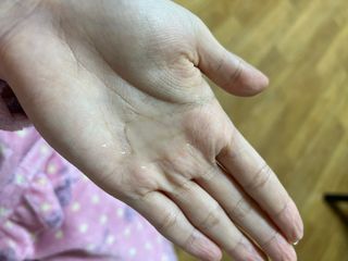 리더스코스메틱 리더스 퍼스트 샷 액티브 에센스 에이지 컨트롤 — 5점을 준 리뷰어가 2021년 11월 올린 사용 사진