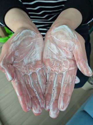 하이브리온 [쿠팡 구매평] 닥터초이스 시카엑소좀 판테놀 아미노산 탈모기능성 두피케어 모근강화 샴푸, 300ml, 1개 — 5점을 준 리뷰어가 2025년 3월 올린 사용 사진