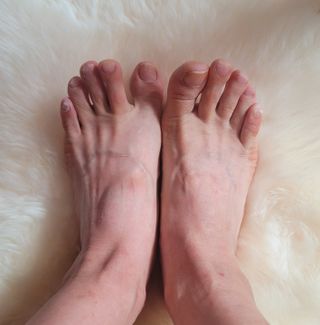 유케어 YOU CARE 문제성 손발톱케어_럭키풋 — 5점을 준 리뷰어가 2022년 9월 올린 사용 사진