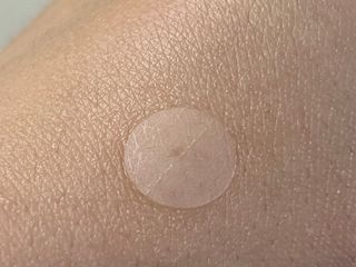세뚜아(Cettua) 세뚜아 스팟 클리어 듀얼 패치 Cettua Spot Clear Dual Patch — 5점을 준 리뷰어가 2023년 6월 올린 사용 사진