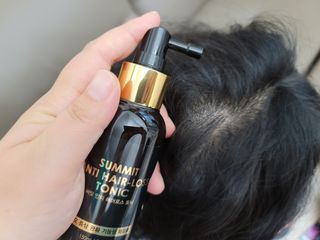 썸헤어 / SUMHAIR 썸헤어 써밋 안티 헤어로스 토닉 — 5점을 준 리뷰어가 2021년 5월 올린 사용 사진