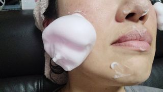 에스투엔디 바이오 포피 무스 트리트먼트 — 5점을 준 리뷰어가 2021년 5월 올린 사용 사진