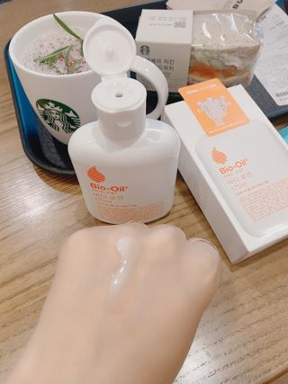 바이오오일 [바이오-오일] 바디 로션 175ml — 5점을 준 리뷰어가 2021년 11월 올린 사용 사진