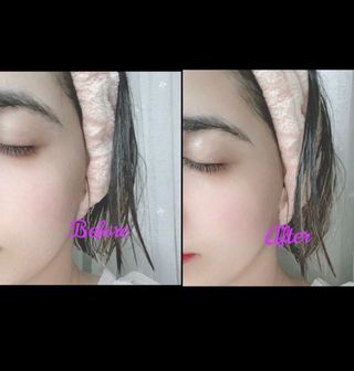 렉스리 닥터 올인원 세럼 Rexri Dr.All-in-one Serum — 3.5점을 준 리뷰어가 2022년 10월 올린 사용 사진