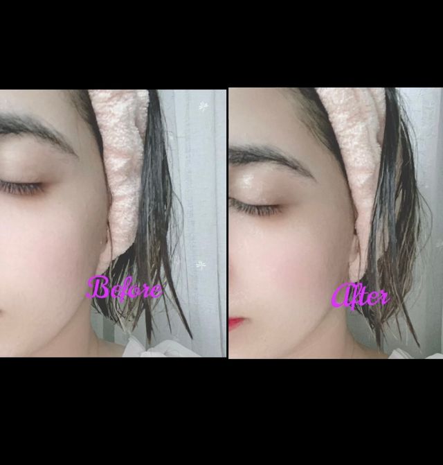 렉스리 닥터 올인원 세럼 Rexri Dr.All-in-one Serum 리뷰 사진