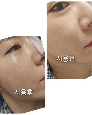 세뚜아(Cettua) [세뚜아] 모이스처 밸런싱 페이셜 마스크 Cettua Moisture Balancing Facial Mask 5매 — 5점을 준 리뷰어가 2024년 3월 올린 사용 사진