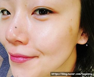 에센느 닥터 멜라닌 화이트닝 앰플 — 5점을 준 리뷰어가 2023년 5월 올린 사용 사진