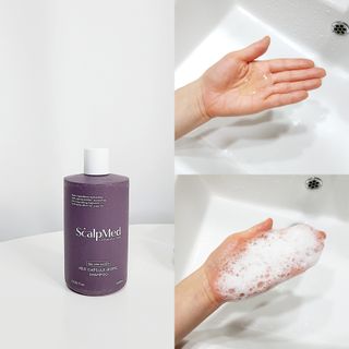 스칼프메드 레드캡슐바이옴 두피케어 프로바이오틱스 유산균 두피관리 세트 — 5점을 준 리뷰어가 2021년 4월 올린 사용 사진