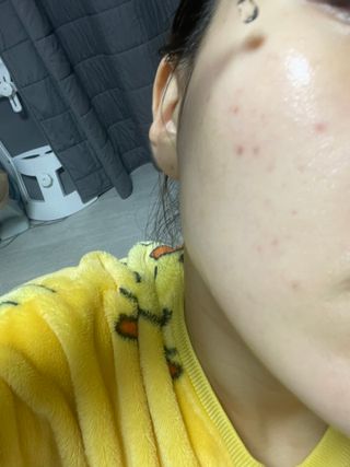오투에니원 갈락토미세스 리바이탈라이징 프리미엄 화이트닝 에센스 50ml — 5점을 준 리뷰어가 2022년 12월 올린 사용 사진