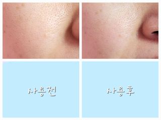 나우 [리브엠]피부 속부터 겹겹이, 촘촘하게! 워터핏8중 수분착붙 크림 — 5점을 준 리뷰어가 2025년 5월 올린 사용 사진