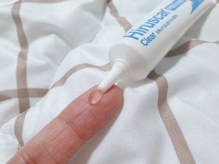 히루스카 포스트아크네 클리어 — 5점을 준 리뷰어가 2021년 2월 올린 사용 사진