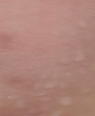 셀바이져 지우개 미스트 피부 보호 입주변 트러블 진정 케어 아기 안개분사 미스트 — 5점을 준 리뷰어가 2021년 2월 올린 사용 사진