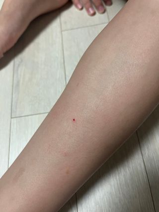 [큐어반H 커팅] 간편하게 떼서 쓰는 자외선차단 습윤밴드 (1팩/30매입) — 5점을 준 리뷰어가 2022년 12월 올린 사용 사진