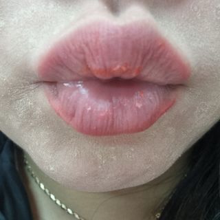 [후르디아] 올리브영 꿀과즙 립밤 2종 (블루베리/석류) — 5점을 준 리뷰어가 2022년 11월 올린 사용 사진