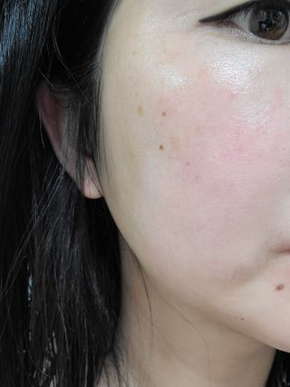 플레라디 에델바이스 오일 밸런싱 토너 — 5점을 준 리뷰어가 2021년 6월 올린 사용 사진