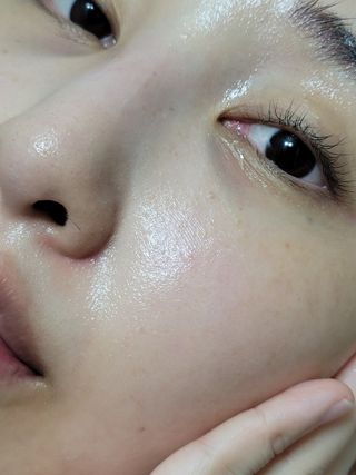바이오오일 [바이오-오일] 드라이 스킨 젤 100ml — 5점을 준 리뷰어가 2021년 9월 올린 사용 사진