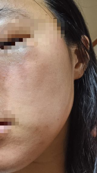 [스킨1004] 마다가스카르 센텔라 앰플 100ml — 5점을 준 리뷰어가 2024년 5월 올린 사용 사진