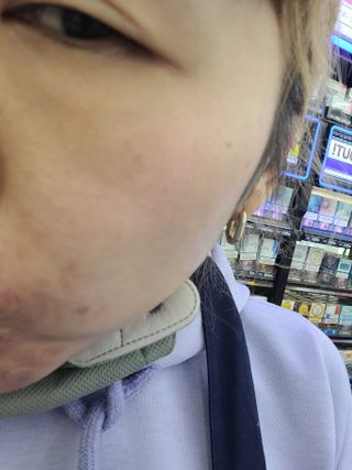 [후르디아] 미백 기능성 감귤 브라이트닝 세럼 — 5점을 준 리뷰어가 2022년 5월 올린 사용 사진
