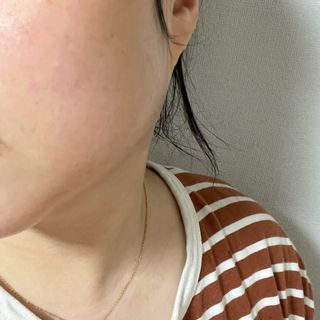 애디팬더 바이오시트앰플 기능성 마스크팩 — 5점을 준 리뷰어가 2021년 5월 올린 사용 사진