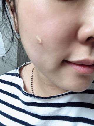 히루스카 포스트아크네 클리어 — 3점을 준 리뷰어가 2021년 1월 올린 사용 사진