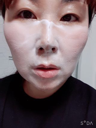 에스투엔디 바이오 포피 무스 트리트먼트 — 5점을 준 리뷰어가 2021년 5월 올린 사용 사진