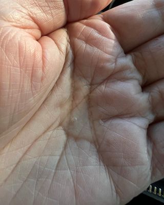 싱크스루 히알루론산 (think THROUGH HYALURONIC ACID Complex-2) — 5점을 준 리뷰어가 2022년 10월 올린 사용 사진