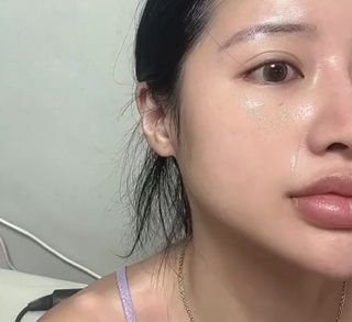 📷프리 (인스타체험단) [밀리밀리] 메디 앰플 시카 15ml — 5점을 준 리뷰어가 2025년 9월 올린 사용 사진