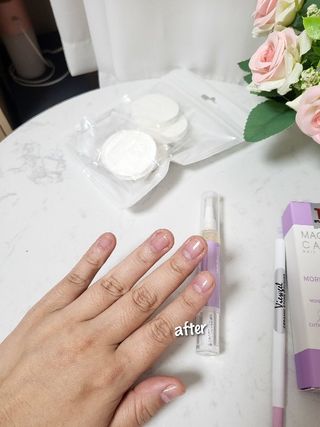1+2 뷰젤 매직케어 손톱영양제+스톤푸셔+코인타올 셀프 네일케어 — 5점을 준 리뷰어가 2022년 10월 올린 사용 사진