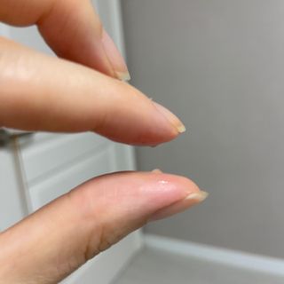 작심연구소 바르는 피부과 레이저 메디스팟크림 플러스 — 3.5점을 준 리뷰어가 2022년 5월 올린 사용 사진