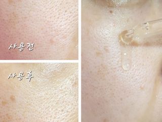 [스킨1004] 마다가스카르 센텔라 앰플 100ml — 5점을 준 리뷰어가 2024년 5월 올린 사용 사진