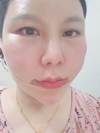 아이디플라코스메틱 아이디 페이스핏 마이너스 밴드 v2 — 5점을 준 리뷰어가 2021년 5월 올린 사용 사진