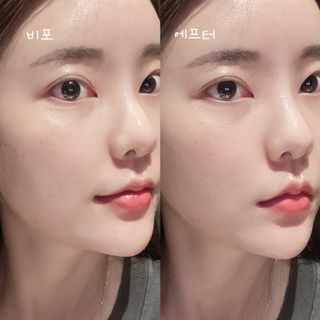 cellpod 셀팟 미세전류 마스크팩 프로그램 MC±WELL 5회분 — 5점을 준 리뷰어가 2022년 3월 올린 사용 사진