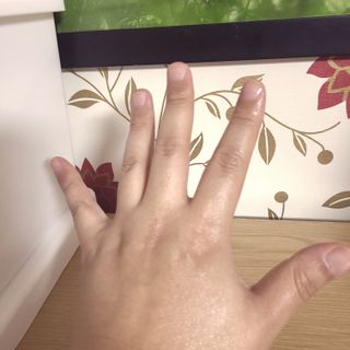 건선/아토/습진/민감성 피부 천연보습진정크림 소리온 크림 & 센시티브 크림 50g — 5점을 준 리뷰어가 2022년 1월 올린 사용 사진