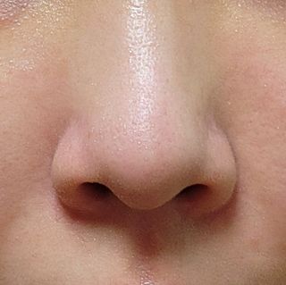 세뚜아(Cettua) 세뚜아 스티키 포어 패치 Cettua Sticky Pore Patch — 4.5점을 준 리뷰어가 2023년 8월 올린 사용 사진