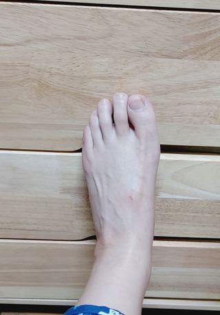 [큐어반H 커팅] 간편하게 떼서 쓰는 자외선차단 습윤밴드 (1팩/30매입) — 5점을 준 리뷰어가 2022년 11월 올린 사용 사진