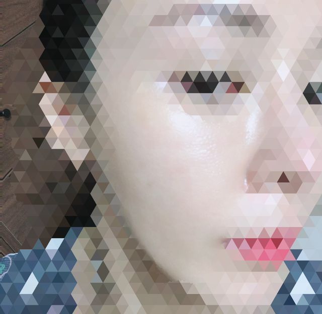 유니베르소 로즈힙 오일 15ml 리뷰 사진
