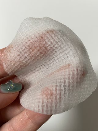 디에이브 더마-테카 바이옴 카밍패드 60매 — 5점을 준 리뷰어가 2022년 12월 올린 사용 사진