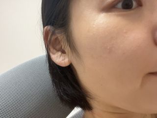 네오메딕스 뷰티 [네오메딕스] 바노바기 피포뮬러 — 5점을 준 리뷰어가 2024년 9월 올린 사용 사진