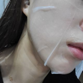 에이스노 레스큐 이미디에이트 수딩 시트마스크 — 5점을 준 리뷰어가 2021년 12월 올린 사용 사진