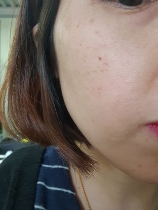 팜스테이 티트리 바이옴 카밍 토너 패드 — 5점을 준 리뷰어가 2022년 4월 올린 사용 사진