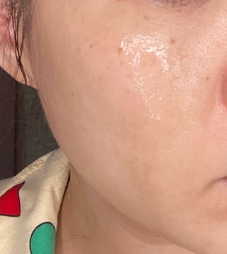 체르엠 스템앤셀 비타민 브라이트닝 에센스 30ml 1개 — 5점을 준 리뷰어가 2022년 4월 올린 사용 사진